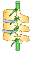 thumnail image